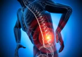 ozonoterapia per ernia
